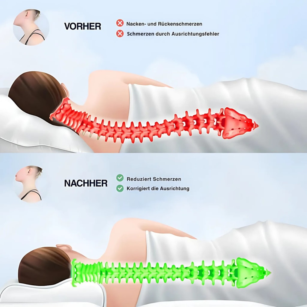 CuroSleep